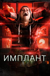  Имплант (2021 ) 